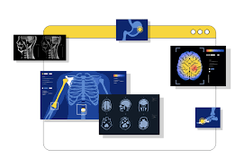 Loan Risk Optimization Dashboard